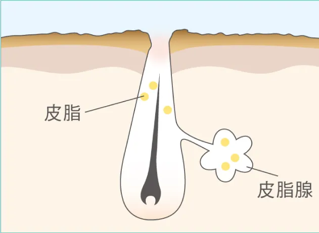 ①角質肥厚が起こる