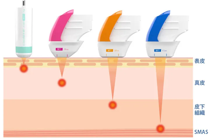 表皮、真皮、皮下組織、SMAS
